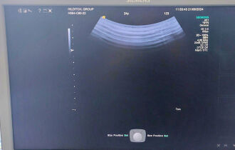 Siemens S1000 Helx Evolution Ultrasound System - 15