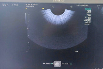 Siemens S1000 Helx Evolution Ultrasound System - 17