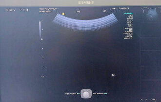 Siemens S1000 Helx Evolution Ultrasound System - 19