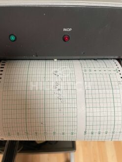 HP 8031A Cardiotocograph - 3