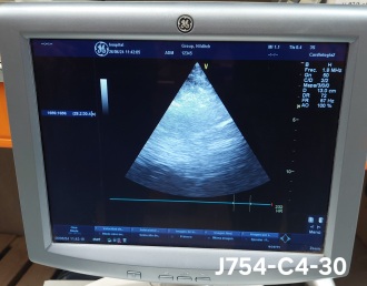 GE Vivid P3 Cardiovascular Ultrasound with 2 Transducers - 17