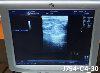 GE Vivid P3 Cardiovascular Ultrasound with 2 Transducers - 19