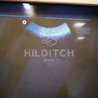 Philips EnVisor Ultrasound - 14