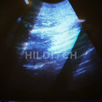 Philips EnVisor Ultrasound - 15