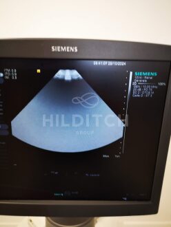 Siemens Acuson S3000 Ultrasound - 19