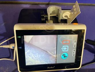 Ambu aView Monitor with Ambu Scope - 3