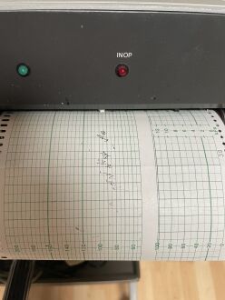 HP 8031A Cardiotocograph - 2