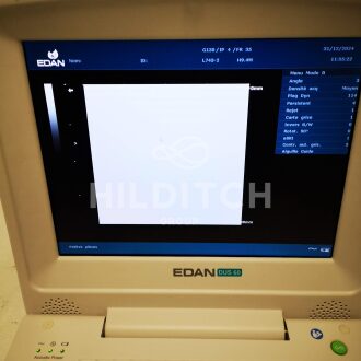 Edan DUS 602 Ultrasound - 4