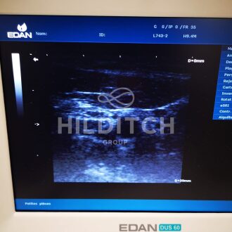 Edan DUS 602 Ultrasound - 13