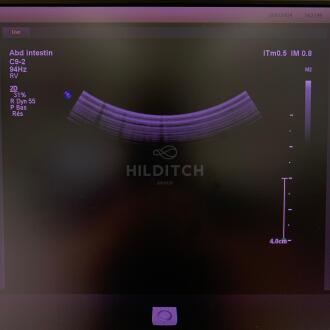 Philips C9-2 Transducer - 4