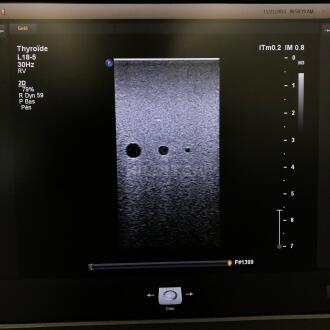 Philips L18-5 Transducer - 5