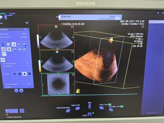 Siemens 4Z1c Transducer - 6