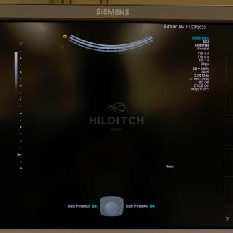 Siemens 6C2 Transducer - 2