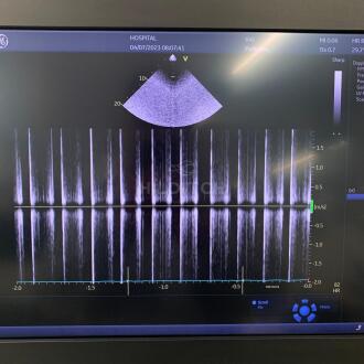 GE 6VC-D Transducer - 6