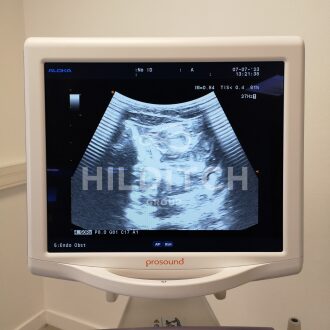 Aloka Prosound 6 Ultrasound - 18