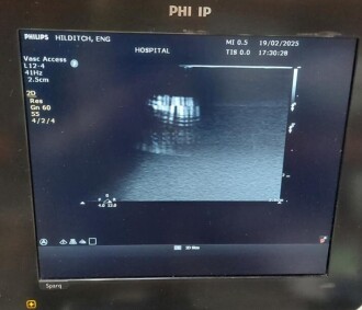 Philips SPARQ Ultrasound - 13