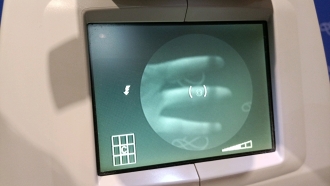 Topcorn NW6S Non-Mydriatic Retinal Camera - 19