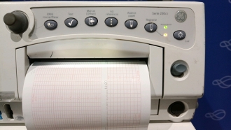 GE 259CX Fetal Monitor - 4