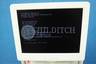 Hitachi EUB 7000 Diagnostic Ultrasound - Damage to Side Panels and Missing Knob on Control Panel *Powers Up* - 4