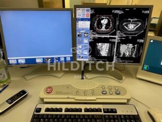 GE Brightspeed Edge 8 Slice CT Scanner - 4