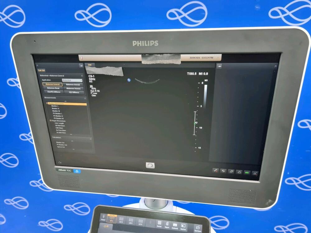Philips Affiniti 70G PureWave Ultrasound