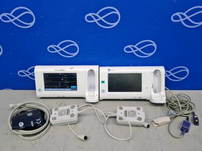 2 x Welch Allyn Connex Spot Monitor