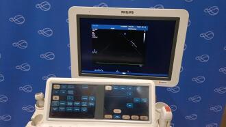 Philips iE33 Ultrasound - 3