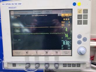 Maquet Servo i Ventilator on Trolley - 5