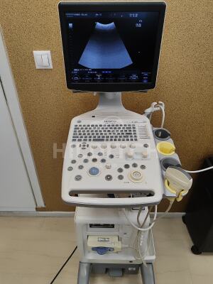 Aloka F37 Ultrasound *10% BUYER PREMIUM*