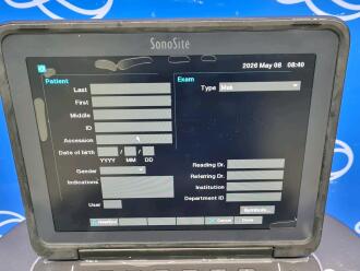 SonoSite Edge II Portable Ultrasound on SonoSite Rollstand - No SD Card - 4