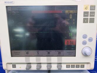 Maquet Servo i Ventilator on Trolley - 5