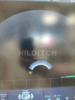 GE Voluson S8 BT15 Ultrasound *10% BUYER PREMIUM* - 7