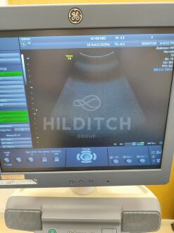 GE Voluson P8 BT13 Ultrasound *10% BUYER PREMIUM* - 4