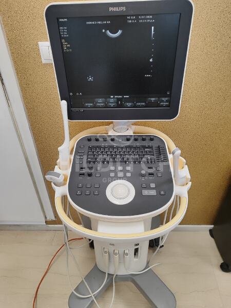 Philips ClearVue 650 Cart B Ultrasound *10% BUYER PREMIUM*