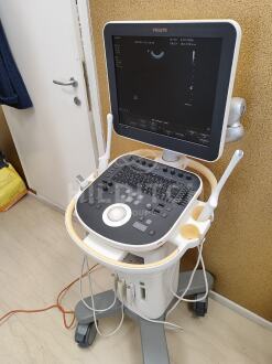 Philips ClearVue 650 Cart B Ultrasound *10% BUYER PREMIUM* - 2
