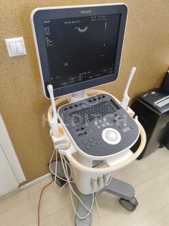 Philips ClearVue 650 Cart B Ultrasound *10% BUYER PREMIUM* - 3