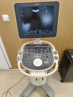 Philips ClearVue 350 Cart A Ultrasound *10% BUYER PREMIUM*