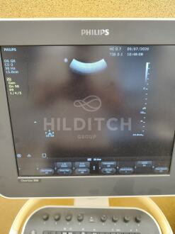 Philips ClearVue 350 Cart A Ultrasound *10% BUYER PREMIUM* - 4