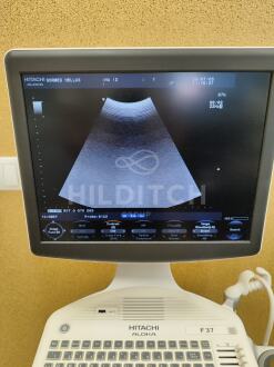 Aloka F37 Ultrasound *10% BUYER PREMIUM* - 4
