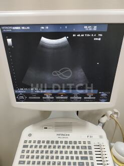 Aloka F31 Ultrasound *10% BUYER PREMIUM* - 4