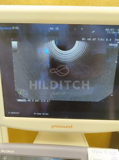 Aloka Alpha 6 Prosound Ultrasound *10% BUYER PREMIUM* - 6