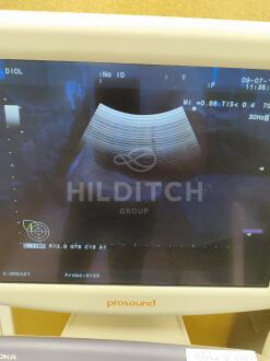 Aloka Alpha 6 Prosound Ultrasound *10% BUYER PREMIUM* - 7