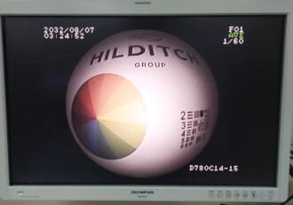 Fujinon EY-470S/B Video Cystoscope - 4