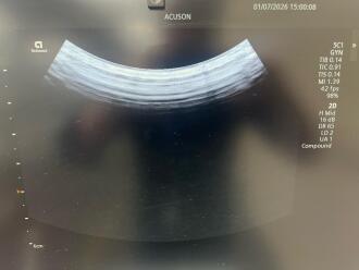 Siemens Healthineers Acuson Redwood Ultrasound System - 14