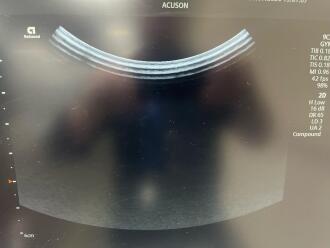 Siemens Healthineers Acuson Redwood Ultrasound System - 15