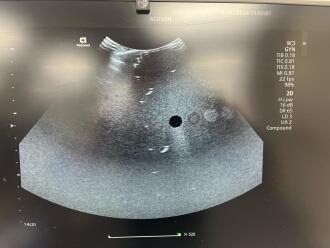 Siemens Healthineers Acuson Redwood Ultrasound System - 16