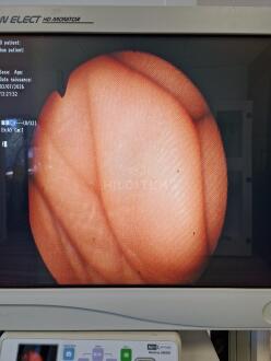3x Olympus CYF-5A Cytoscopes - 11