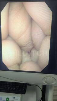 Olympus GIF-N180 Gastroscope - 3
