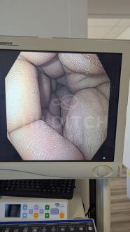 Olympus GIF-H180 Gastroscope - 8