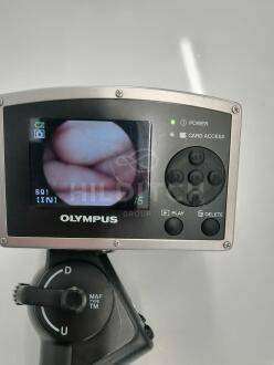 Olympus MAF-TM Bronchoscope - 6